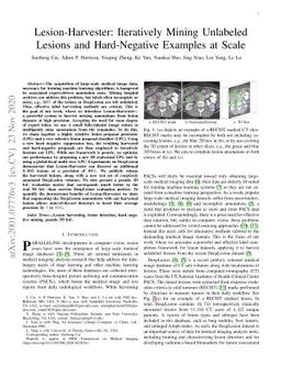 Lesion Harvester: Iteratively Mining Unlabeled Lesions and Hard-Negative
  Examples at Scale