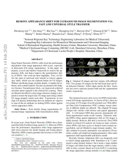 Remove Appearance Shift for Ultrasound Image Segmentation via Fast and
  Universal Style Transfer