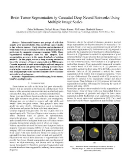 Brain Tumor Segmentation by Cascaded Deep Neural Networks Using Multiple
  Image Scales
