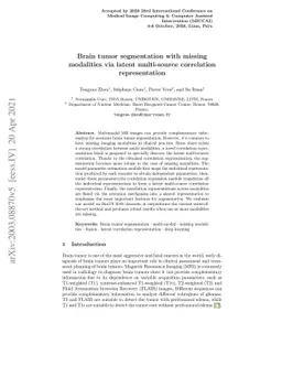 Brain tumor segmentation with missing modalities via latent multi-source
  correlation representation