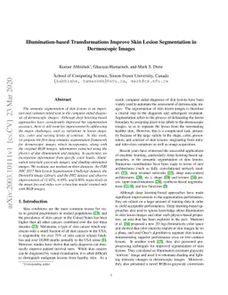 Illumination-based Transformations Improve Skin Lesion Segmentation in
  Dermoscopic Images