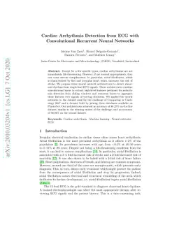 Cardiac Arrhythmia Detection from ECG with Convolutional Recurrent
  Neural Networks