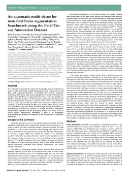An automatic multi-tissue human fetal brain segmentation benchmark using
  the Fetal Tissue Annotation Dataset