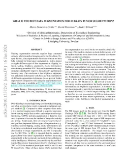 What is the best data augmentation for 3D brain tumor segmentation?