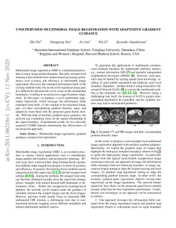 Unsupervised Multimodal Image Registration with Adaptative Gradient
  Guidance