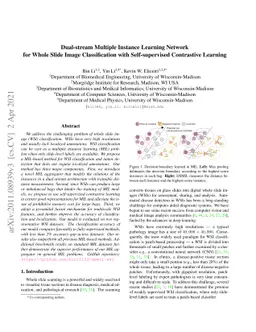 Dual-stream Multiple Instance Learning Network for Whole Slide Image
  Classification with Self-supervised Contrastive Learning
