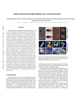 Multiresolution Knowledge Distillation for Anomaly Detection
