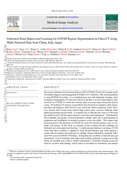 Federated Semi-Supervised Learning for COVID Region Segmentation in
  Chest CT using Multi-National Data from China, Italy, Japan