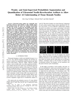 Weakly- and Semi-Supervised Probabilistic Segmentation and
  Quantification of Ultrasound Needle-Reverberation Artifacts to Allow Better
  AI Understanding of Tissue Beneath Needles