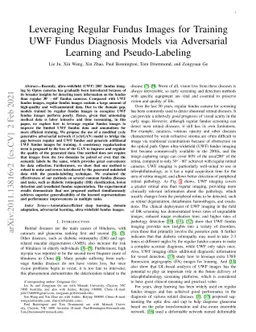 Leveraging Regular Fundus Images for Training UWF Fundus Diagnosis
  Models via Adversarial Learning and Pseudo-Labeling
