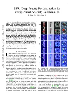 DFR: Deep Feature Reconstruction for Unsupervised Anomaly Segmentation