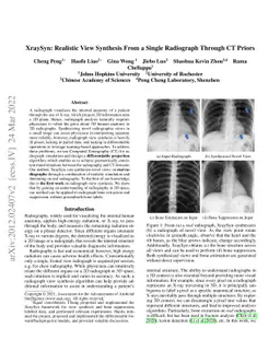 XraySyn: Realistic View Synthesis From a Single Radiograph Through CT
  Priors