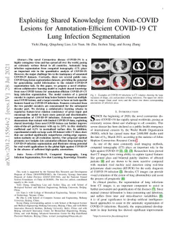 Exploiting Shared Knowledge from Non-COVID Lesions for
  Annotation-Efficient COVID-19 CT Lung Infection Segmentation