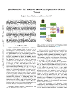QuickTumorNet: Fast Automatic Multi-Class Segmentation of Brain Tumors
