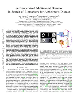 Self-Supervised Multimodal Domino: in Search of Biomarkers for
  Alzheimer's Disease