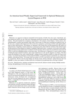 An Attention-based Weakly Supervised framework for Spitzoid Melanocytic
  Lesion Diagnosis in WSI