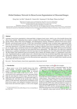 Global Guidance Network for Breast Lesion Segmentation in Ultrasound
  Images