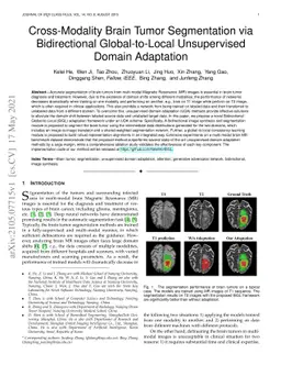 Cross-Modality Brain Tumor Segmentation via Bidirectional
  Global-to-Local Unsupervised Domain Adaptation