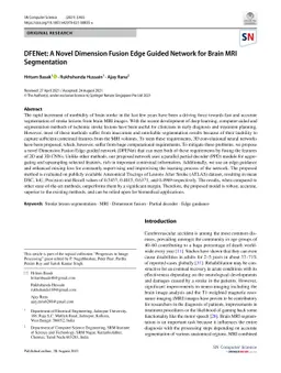 DFENet: A Novel Dimension Fusion Edge Guided Network for Brain MRI
  Segmentation