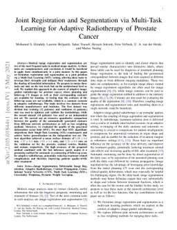 Joint Registration and Segmentation via Multi-Task Learning for Adaptive
  Radiotherapy of Prostate Cancer
