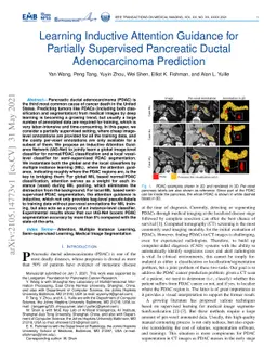 Learning Inductive Attention Guidance for Partially Supervised
  Pancreatic Ductal Adenocarcinoma Prediction
