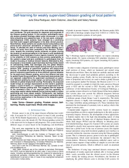 Self-learning for weakly supervised Gleason grading of local patterns