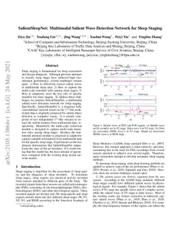 SalientSleepNet: Multimodal Salient Wave Detection Network for Sleep
  Staging