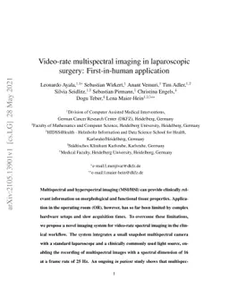 Video-rate multispectral imaging in laparoscopic surgery: First-in-human
  application