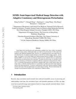 SSMD: Semi-Supervised Medical Image Detection with Adaptive Consistency
  and Heterogeneous Perturbation