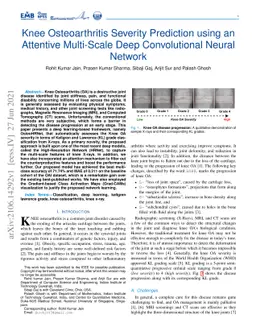 Knee Osteoarthritis Severity Prediction using an Attentive Multi-Scale
  Deep Convolutional Neural Network