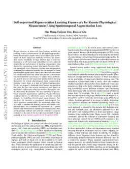 Self-supervised Representation Learning Framework for Remote
  Physiological Measurement Using Spatiotemporal Augmentation Loss