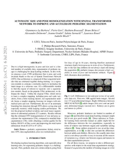 Automatic size and pose homogenization with spatial transformer network
  to improve and accelerate pediatric segmentation