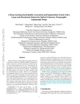 A Deep Learning-based Quality Assessment and Segmentation System with a
  Large-scale Benchmark Dataset for Optical Coherence Tomographic Angiography
  Image