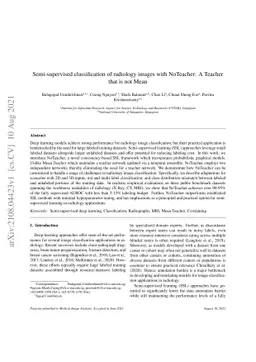 Semi-supervised classification of radiology images with NoTeacher: A
  Teacher that is not Mean