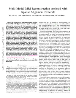 Multi-Modal MRI Reconstruction Assisted with Spatial Alignment Network