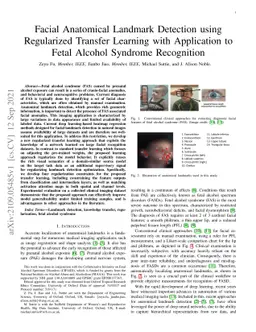 Facial Anatomical Landmark Detection using Regularized Transfer Learning
  with Application to Fetal Alcohol Syndrome Recognition