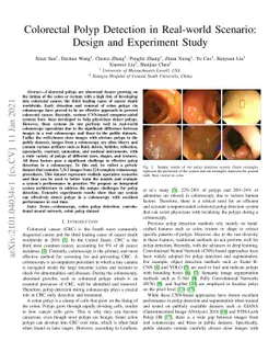 Colorectal Polyp Detection in Real-world Scenario: Design and Experiment
  Study