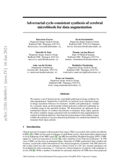 Adversarial cycle-consistent synthesis of cerebral microbleeds for data
  augmentation