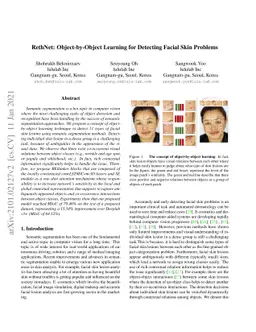 RethNet: Object-by-Object Learning for Detecting Facial Skin Problems