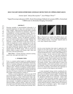 Self-Taught Semi-Supervised Anomaly Detection on Upper Limb X-rays