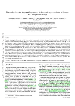 Fine-tuning deep learning model parameters for improved super-resolution
  of dynamic MRI with prior-knowledge