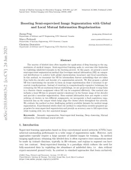 Boosting Semi-supervised Image Segmentation with Global and Local Mutual
  Information Regularization