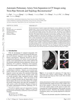 Automatic Pulmonary Artery-Vein Separation in CT Images using Twin-Pipe
  Network and Topology Reconstruction