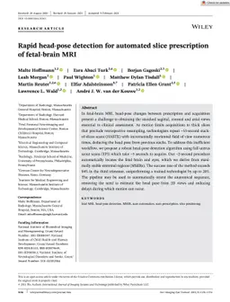 Rapid head-pose detection for automated slice prescription of
  fetal-brain MRI
