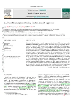 GAN-based disentanglement learning for chest X-ray rib suppression