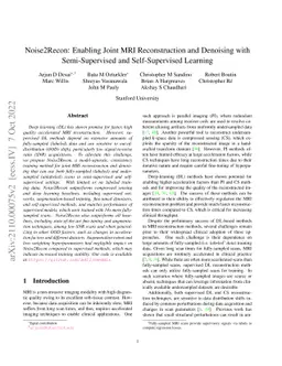Noise2Recon: Enabling Joint MRI Reconstruction and Denoising with
  Semi-Supervised and Self-Supervised Learning