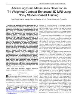 Advancing Brain Metastases Detection in T1-Weighted Contrast-Enhanced 3D
  MRI using Noisy Student-based Training