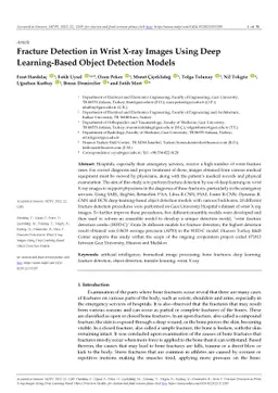 Fracture Detection in Wrist X-ray Images Using Deep Learning-Based
  Object Detection Models