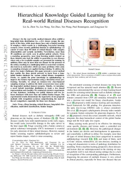 Hierarchical Knowledge Guided Learning for Real-world Retinal Diseases
  Recognition
