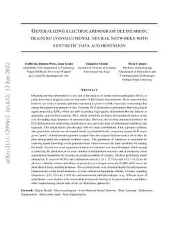 Generalizing electrocardiogram delineation -- Training convolutional
  neural networks with synthetic data augmentation